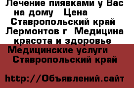 Лечение пиявками у Вас на дому › Цена ­ 200 - Ставропольский край, Лермонтов г. Медицина, красота и здоровье » Медицинские услуги   . Ставропольский край